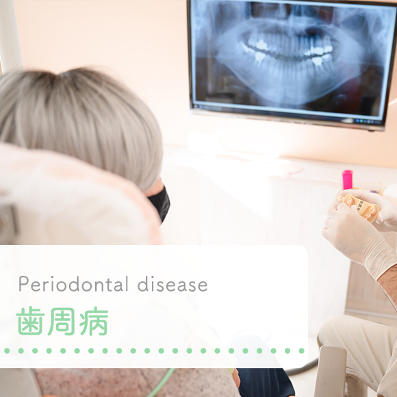 歯周病
